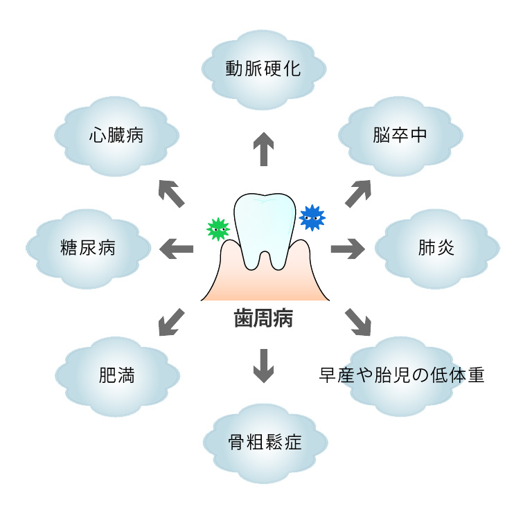 歯周病は身体全体に影響します